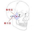 颧弓缩窄手术