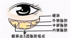 重庆哪家医院祛眼袋做得好