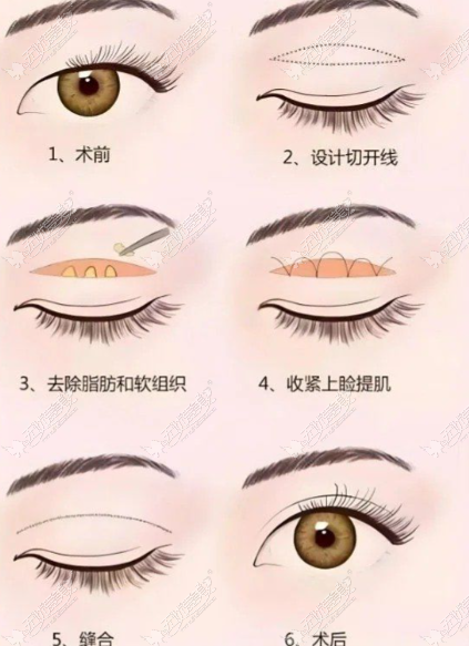 精细修复流程: 精细修复流程: