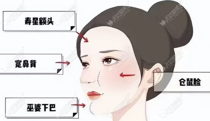 什么是“脸部馒化”？