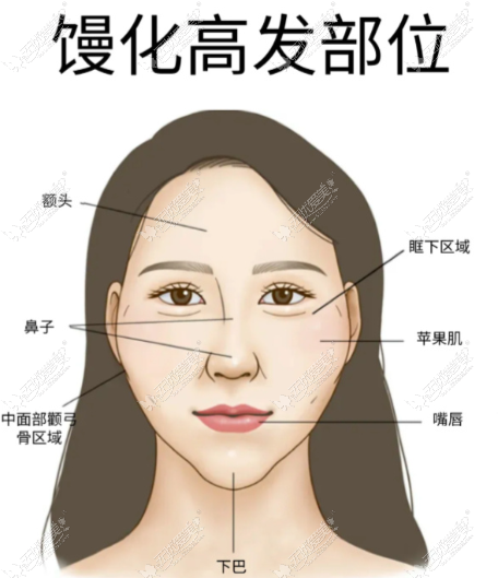 如果不幸“馒化”了，科学应对之道
