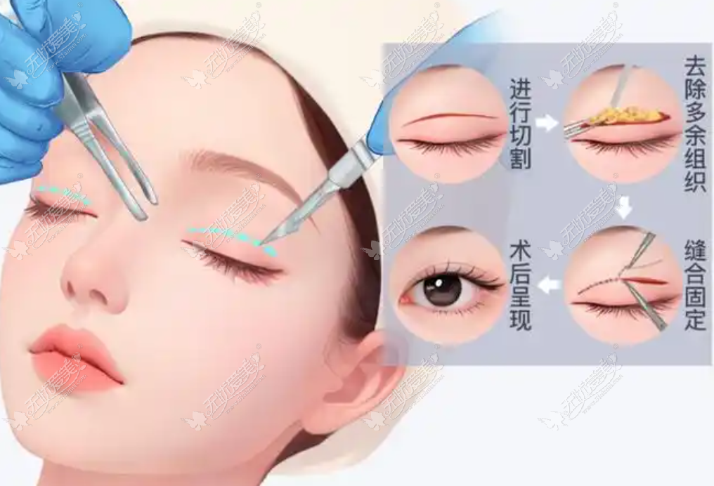 上海杜园园修复好贵www.51aimei.com