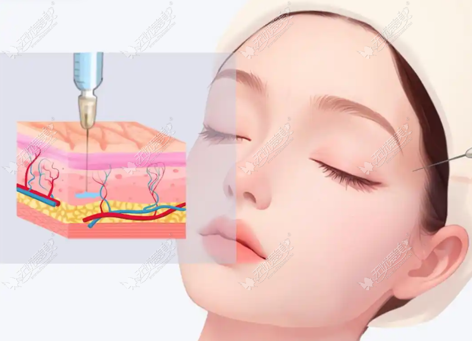 蒋铮铮注射价格表