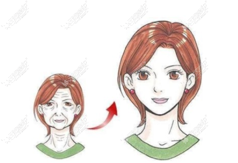 郑州宋连城面部拉皮手术技术咋样