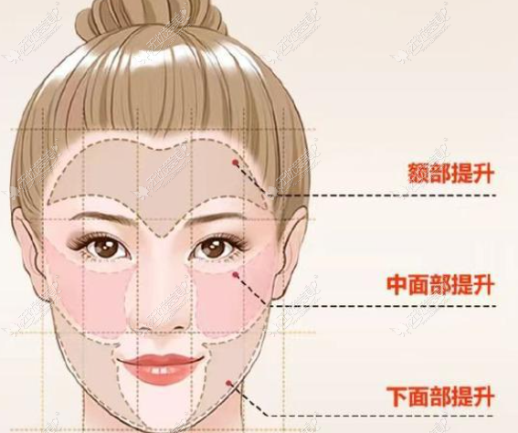 真实范例见证——郑州拉皮医生宋连城怎么样？