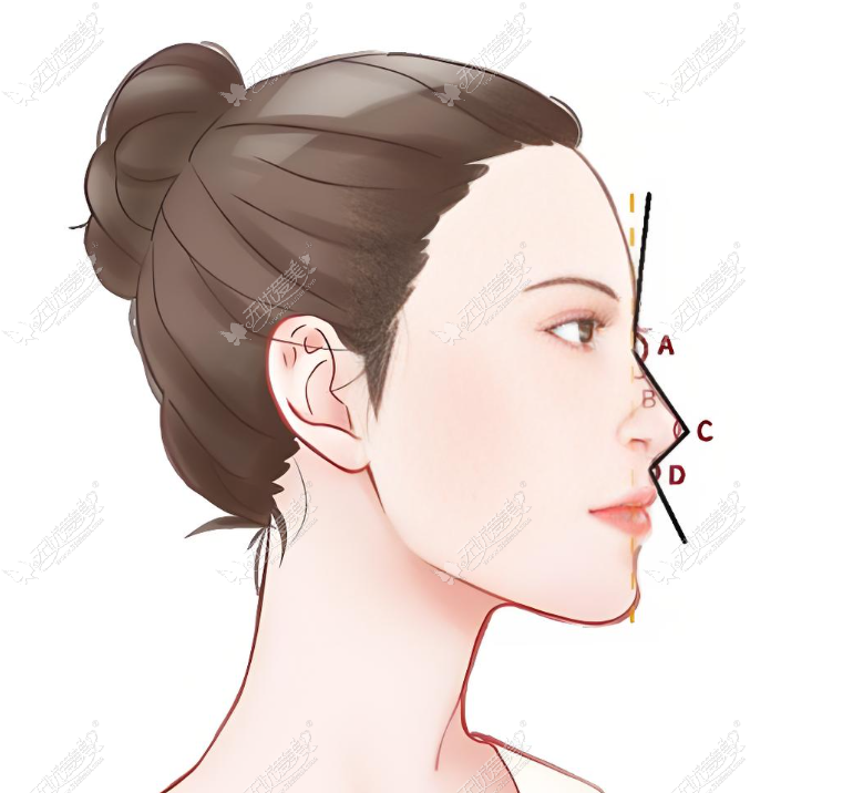 蒋铮铮鼻子注射对比图好不好 蒋铮铮鼻子注射对比图好不好