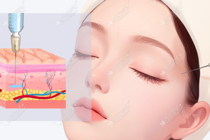 轻薄针一年后的成效变化观察