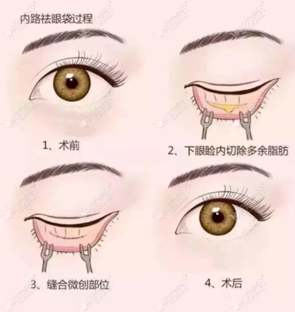 安荃：郑州美莱的医疗标准