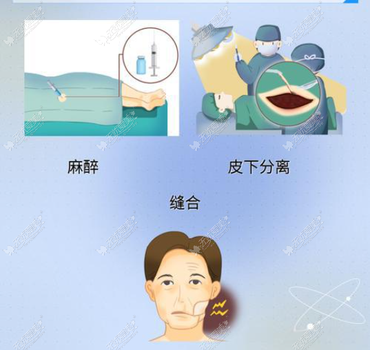 黄寅守为什么那么贵