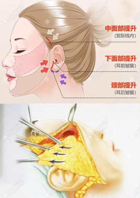 黄寅守医生骗人吗真实实例视频www.51aimei.com