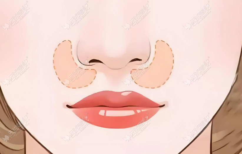 20260416170012987.png image.png