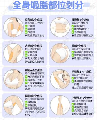 土麦森吸脂部位 土麦森吸脂部位