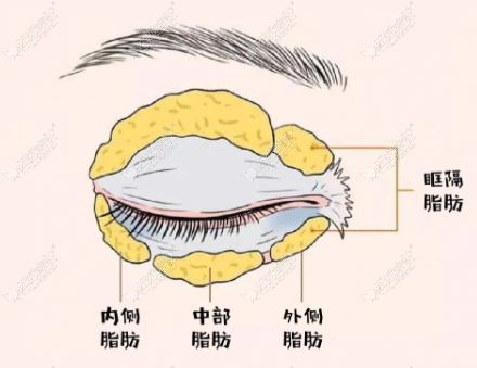 为什么大家都盯着珠海王倜割眼袋价格？