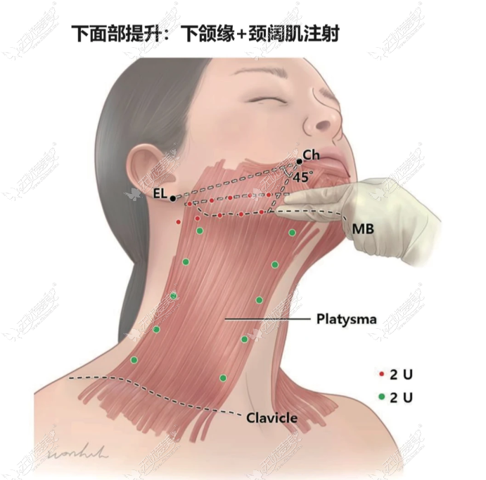 冯啸医生真的打得好吗真实反馈来了！美卫士上翻到一堆术后素颜图，自己品