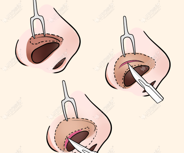 20260421154413628.png image.png