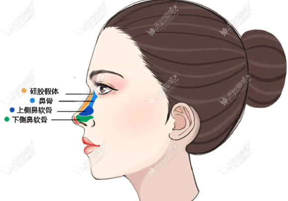 佛山美莱王燕医生鼻综合口碑值得选吗？