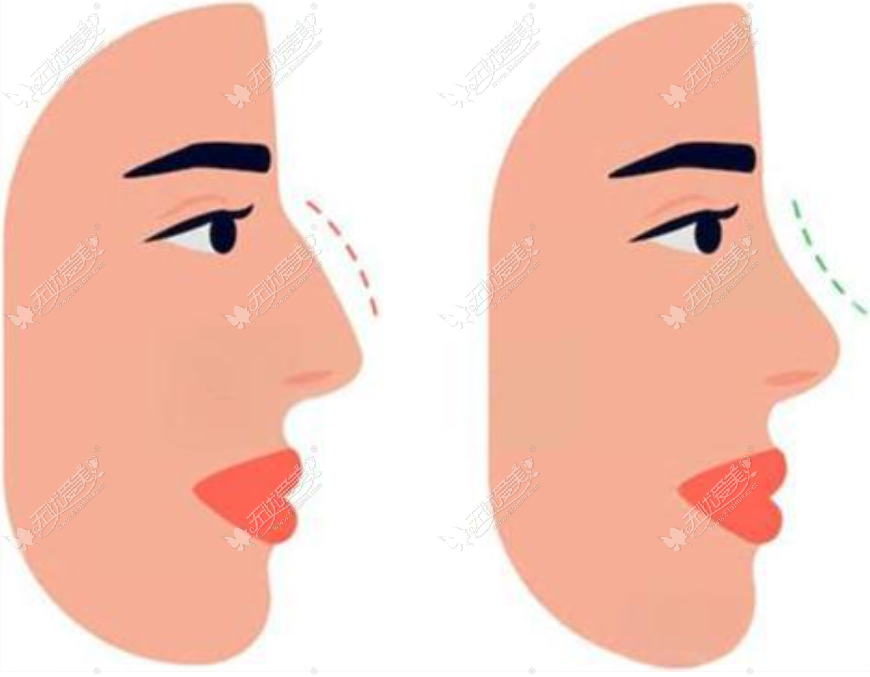 20260507164676217.png image.png