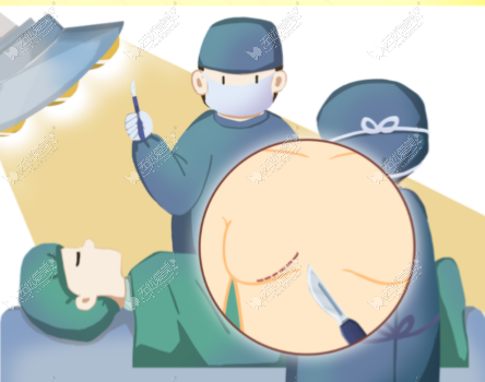 成都八大处侯典举隆胸预约档期紧吗?揭秘手术价格明细与医生选择攻略