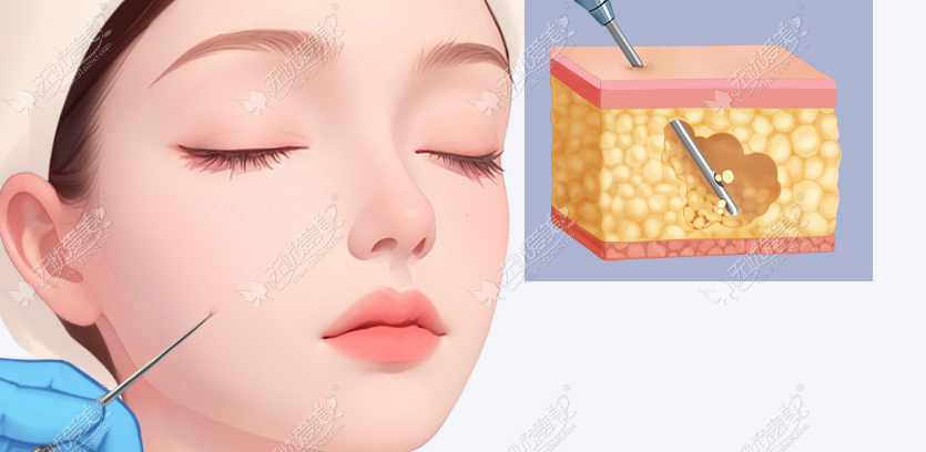 20260519112410624.png image.png