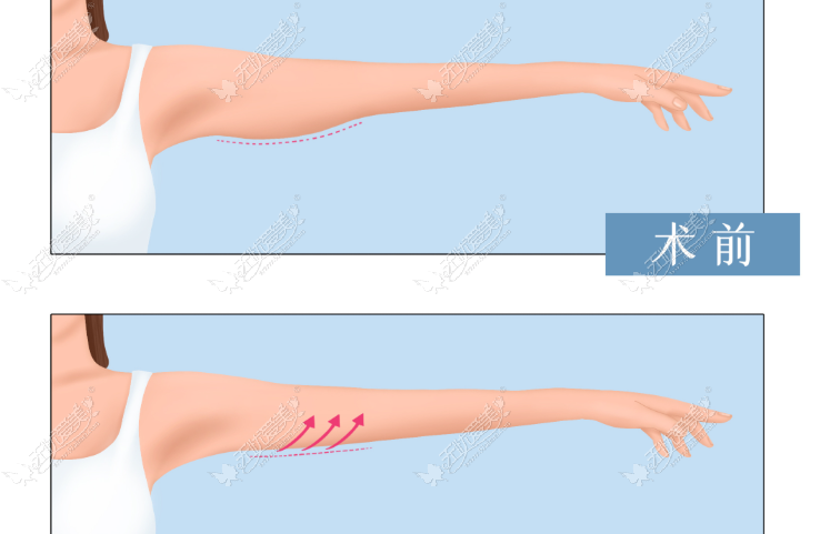 20260519112568093.png image.png