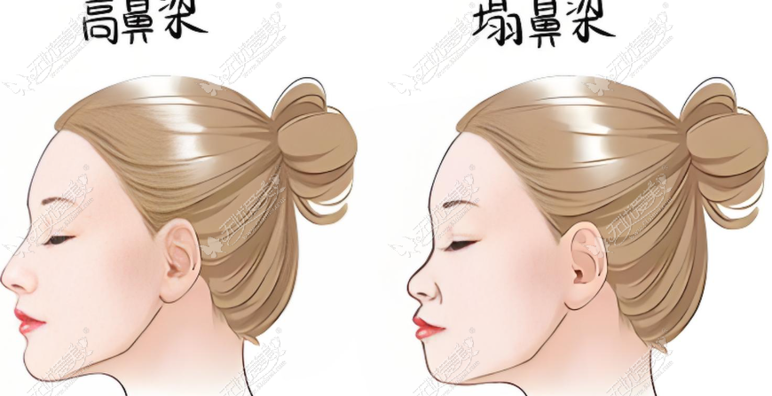 在美卫士APP上翻到成都铜雀台杨加富的执业信息,他做眼修复闭眼痕迹处理得挺细的,有人约过面诊吗