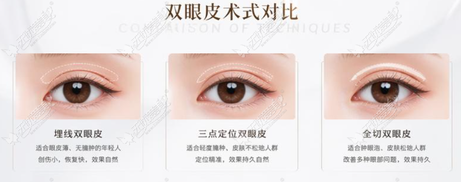 师丽丽双眼皮修复价格参考