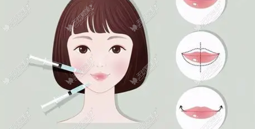天生厚唇想改M唇怕留疤？在美卫士app查好档期，终于约到了李辉M唇形面诊