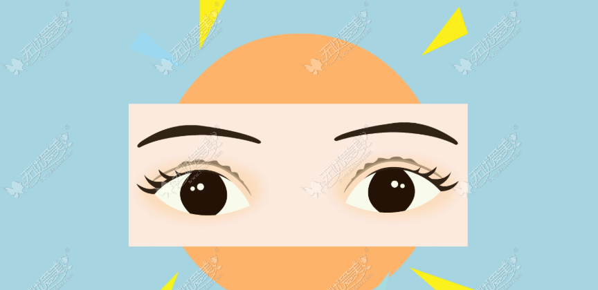 双眼皮做成“肉条眼”真没救了?刚约上杨晓红的修复档期,分享我的面诊避坑实录,把心态放平了!
