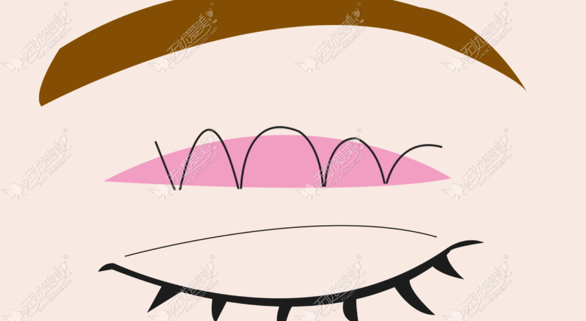 20260521095786468.png image.png