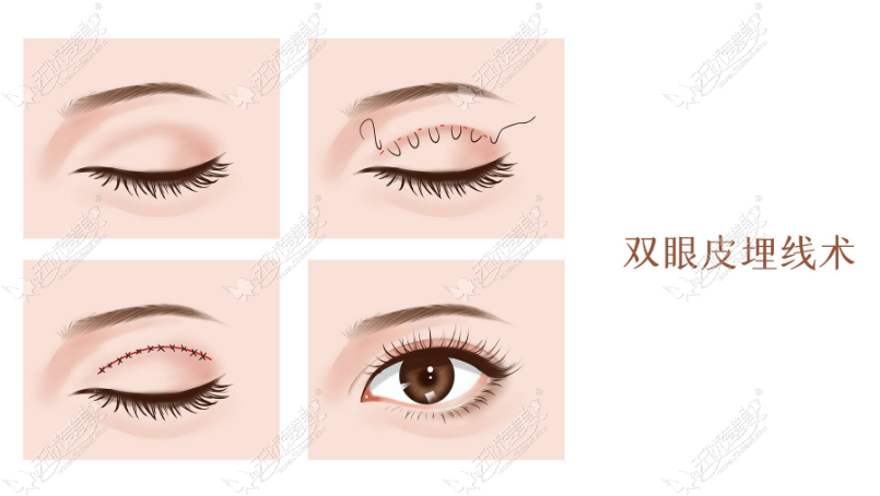 20260521095799863.png image.png