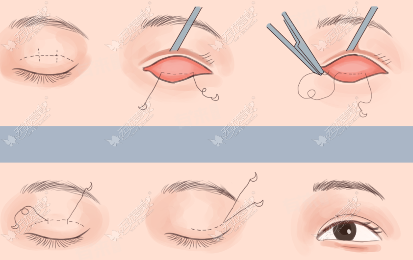 20260525140210036.png image.png