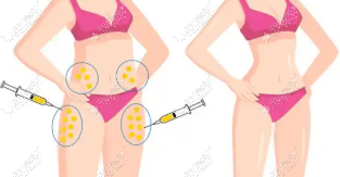 产后肚皮像"围裙"？在美卫士App查阅于世川腹壁成形攻略，热门手术档期抢先约