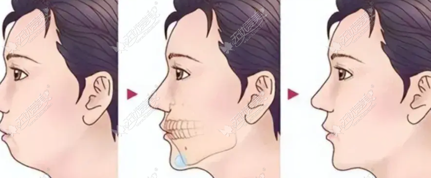 20260527140710979.png image.png