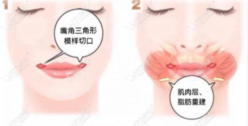 20260527141123159.png image.png