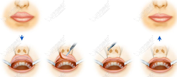 20260527141169651.png image.png