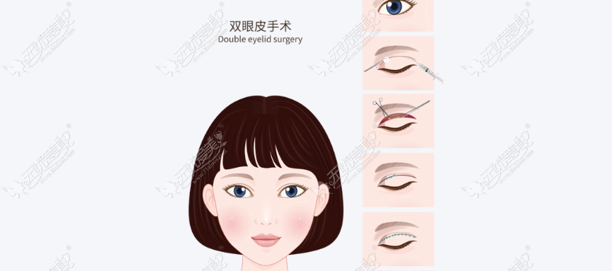 高难度眼修复该找谁?深度实测佀同帅修复逻辑,附解决肉条感与不对称面诊攻略