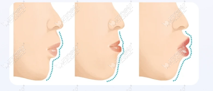 20260527163012108.png image.png