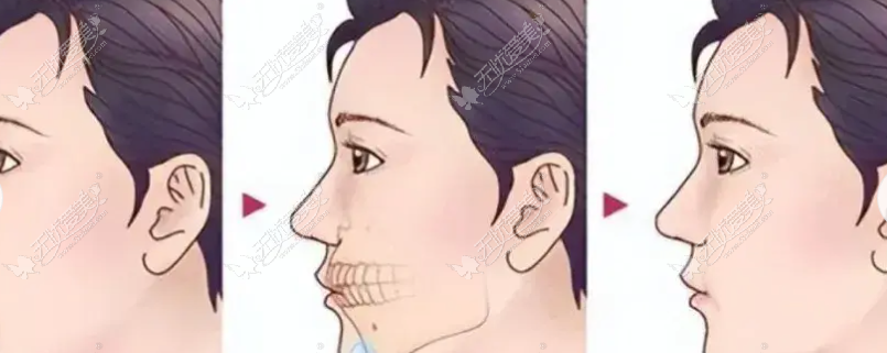 20260528155610056.png image.png