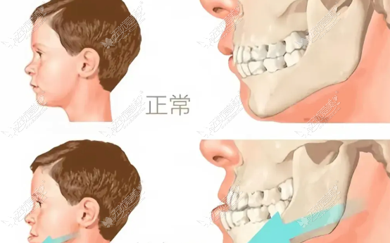 20260528155713879.png image.png