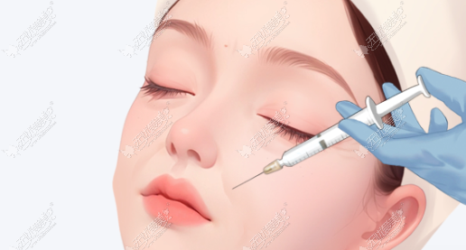 广州打玻尿酸脸僵馒化是怎么回事？余维忠的骨相支撑打法解释清楚了