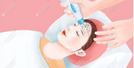 广州热玛吉做完为什么没疗效？余时间的能量打法说清楚了，面诊时讲透了