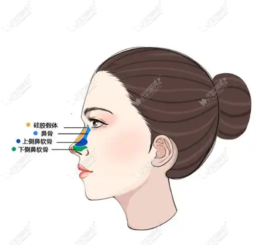 可实在哩,太原陈柳艺做鼻子怎么样嫂子搁美卫士上查完去做了摸着是软的捏着跟真的一样