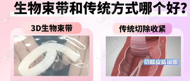 20260603180555321.png image.png