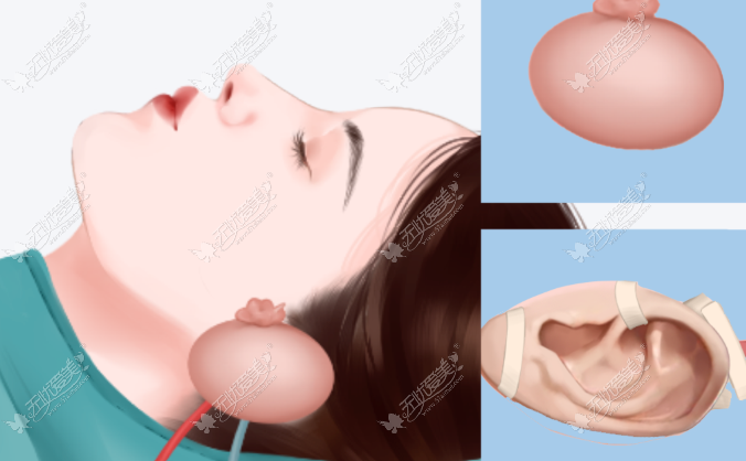 20260610185811797.png image.png