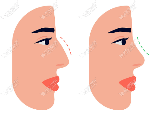 20260617110612146.png image.png