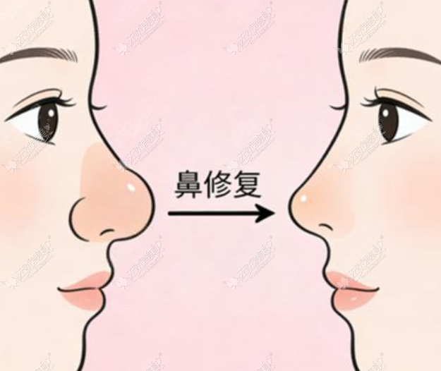 20260617110763988.png image.png