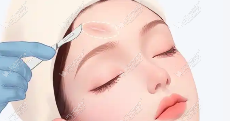 20260626155756431.png image.png