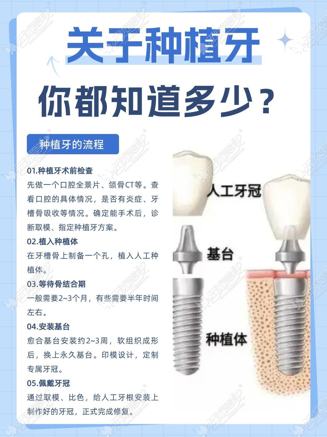 贝色小牛-种植牙10.jpg