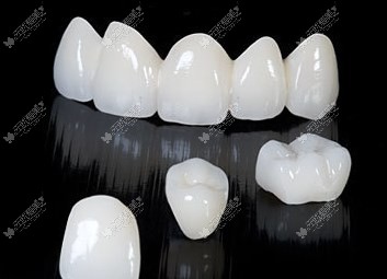 贝色小程序查询北京牙贴面费用
